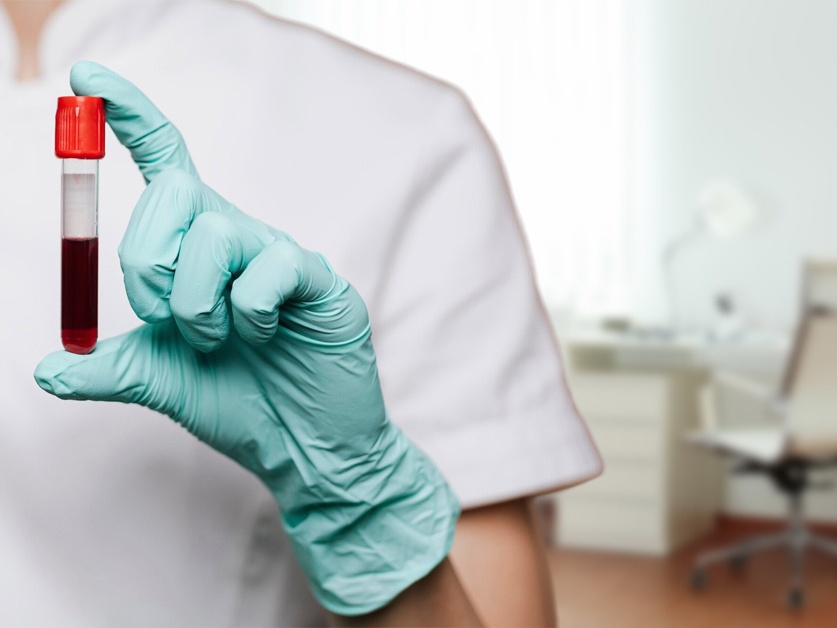 Standardní ambulance hematologicko-onkologického oddělení - FN Plzeň