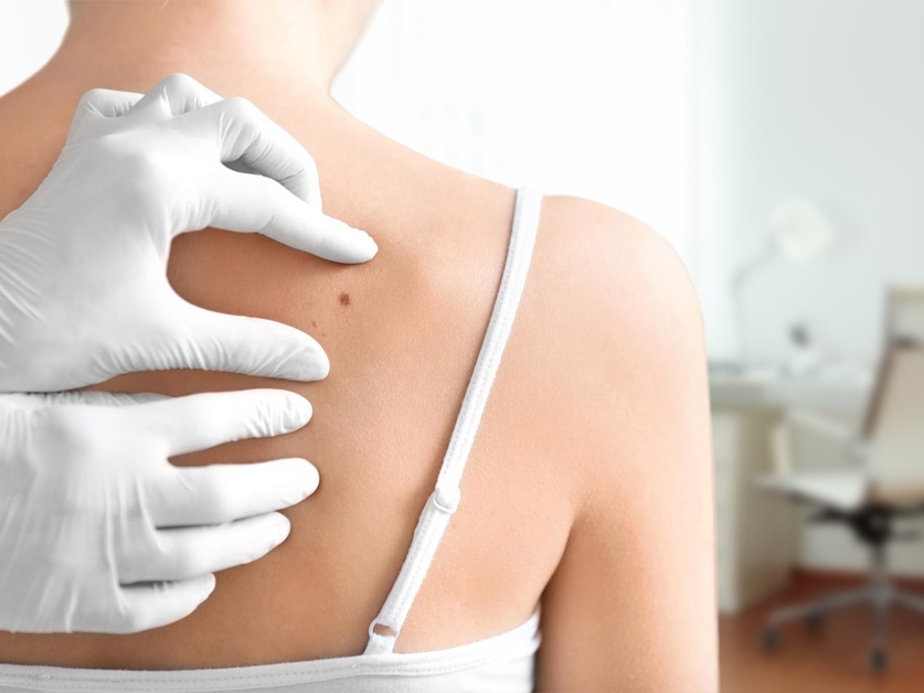 Kožní ambulance - MUDr. Jan Kilián