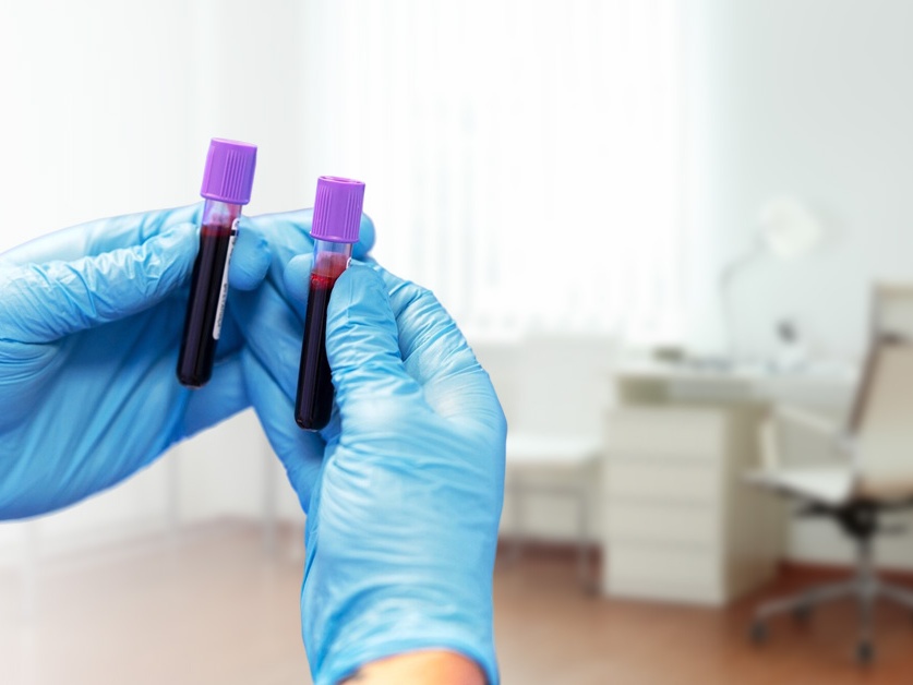 Biochemická laboratoř - Poliklinika Bory